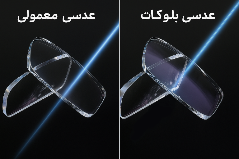 عدسی بلوکات